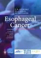 Cover image for Esophageal Cancer