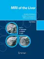 Cover image for MRI of the Liver
