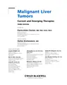 Cover image for Malignant liver tumors