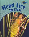 Cover image for Head Lice Up Close (Perspectives)