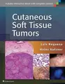 Cover image for Cutaneous Soft Tissue Tumors
