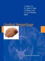 Cover image for Cerebral Hemorrhage