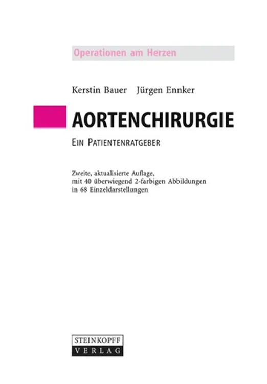 Aortenchirurgie: Ein Patientenratgeber cover