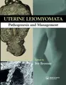 Cover image for Uterine Leiomyomas