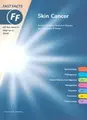 Cover image for Skin Cancer Fast Facts