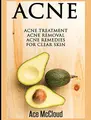 Cover image for Acne : Acne Treatment : Acne Removal