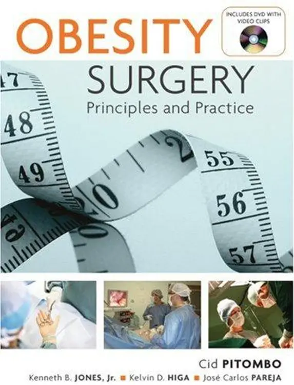 Obesity Surgery: Principles and Practice cover