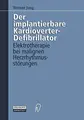 Cover image for Der implantierbare Kardioverter-Defibrillator
